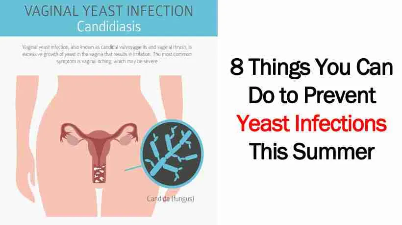 Candida 4 vaginal yeast infection