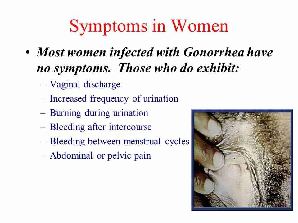 gonorrhoea symptoms women